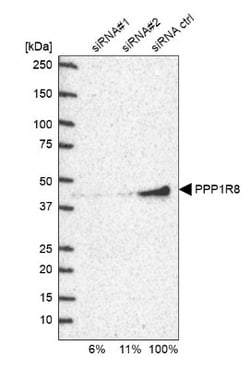 NIPP1 Antibody, Novus Biologicals:Antibodies:Primary Antibodies